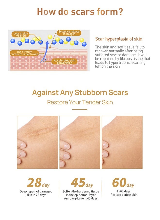 LANBENA - Skin Care Gel,Herbal repair scar cream 30g, scar gel, skin repair gel, natural plant ingredients, effectively repair old and new scars, burns, stretch marks, acne, sunburn (30g) - Image 1