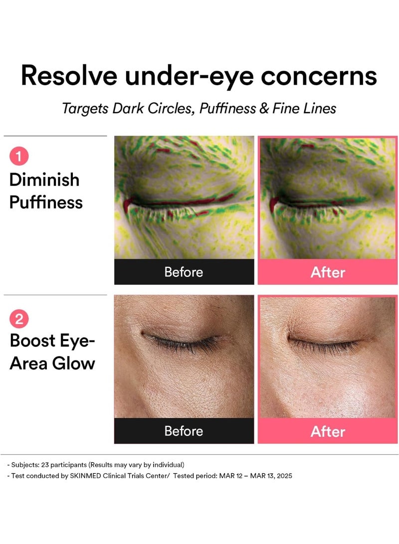 ابيب رقعة العين الشبكية من أبيب بي دي آر إن 60 رقعة، رقعات كورية تحت العين للعيون المنتفخة والهالات السوداء، مضادة للتجاعيد والكولاجين والكافيين والنياسيناميد - Image 4