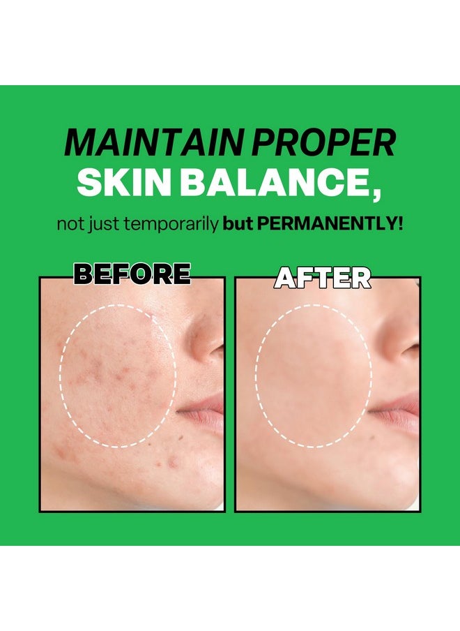 Troubless Mild Clear Toner Essence Skin Moisturizing & Soothing Toner For Face Tea Tree Facial Toner For All Skin Types Hydrating Skin Toner Daily Skin Care (6.76 Fl Oz)  - Image 5