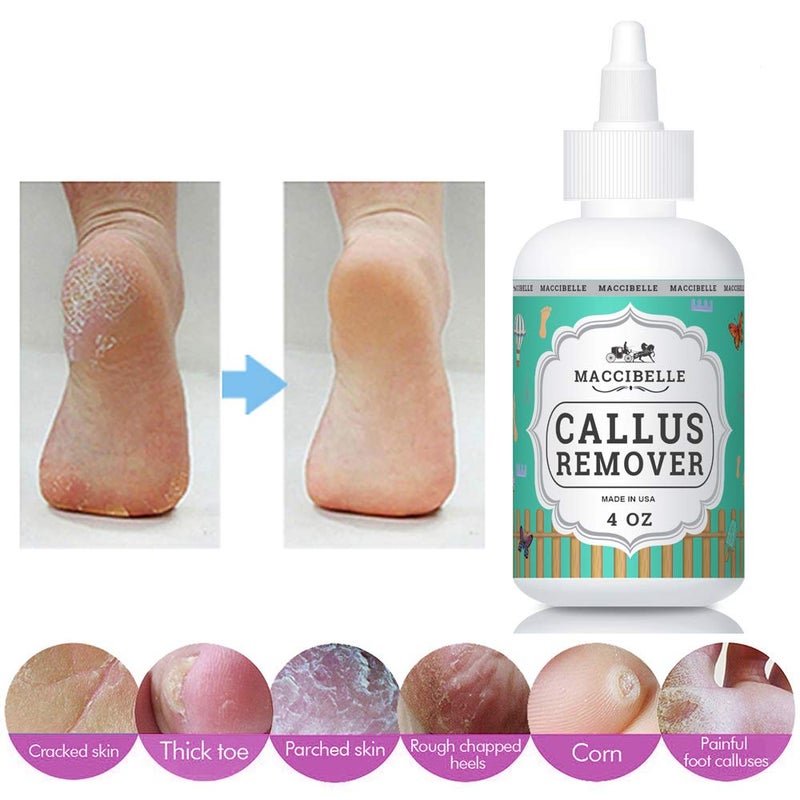 maccibelle مزيل الكالو ماكسيبيل EXTRA STRENGTH للقدمين، سائل جل محترف لإزالة الكالو والذرة 4 أونصات (1 زجاجة) - Image 2