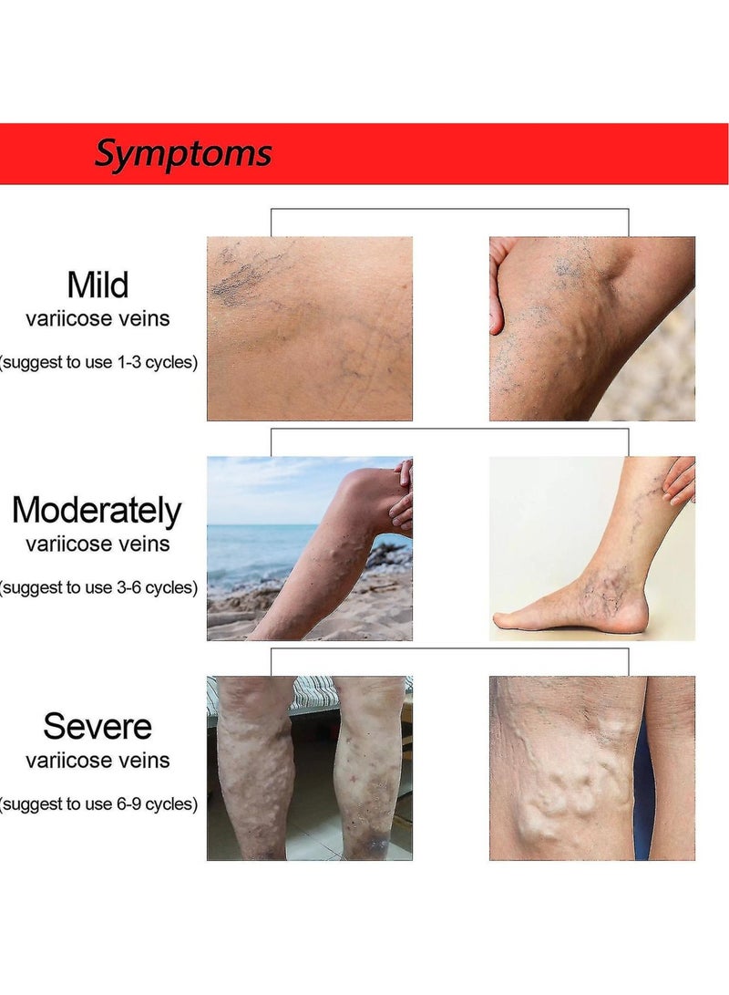 Jaysuing Varicose Veins Patches for Legs to Improve Blood Circulation Strengthen Capillary Health Relieve Swelling Pain and Fatigue Minimize Varicose Vein and Spider Vein 12 Pcs/Pack  - Image 2