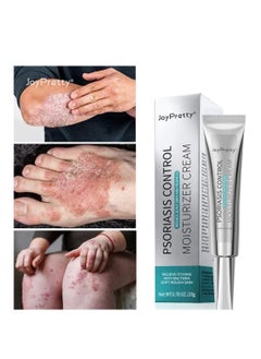 JoyPretty Psoriasis Relief Cream (20g), Anti-Bacterial Moisturizer for Scaly Skin & Redness – Natural Herbal Cream for Eczema, Dermatitis, Psoriasis, and Vitiligo – Unisex Skincare Solution  - Image 2