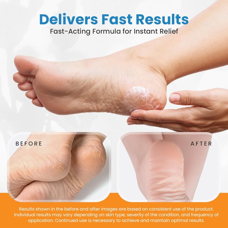 activelife Revitaderm 4D Urea Cream 40% for Feet, Intensive Moisturizing Foot Cream for Dry, Rough, Callused Skin, Includes Free Pumice Stone and Exfoliating Brush, Fast-Absorbing, Fragrance-Free, 4oz, 1 Pack - Image 4