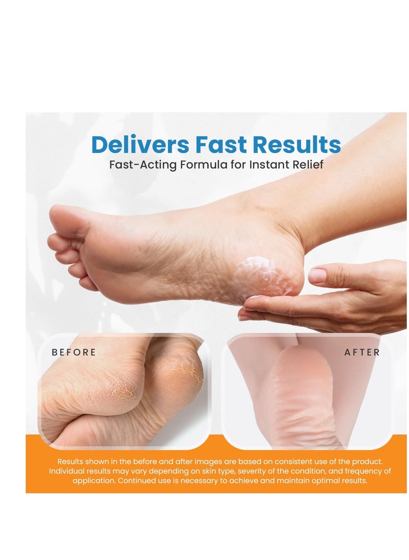 activelife - Revitaderm 4D Urea Cream, Deeply Moisturizes for Dry, Cracked Feet, Hands, Elbows and Knees, Ultra Repair Cream and Callus Remover For Feet, Free Pumice Stone Included, 4oz, 1 Pack - Image 1