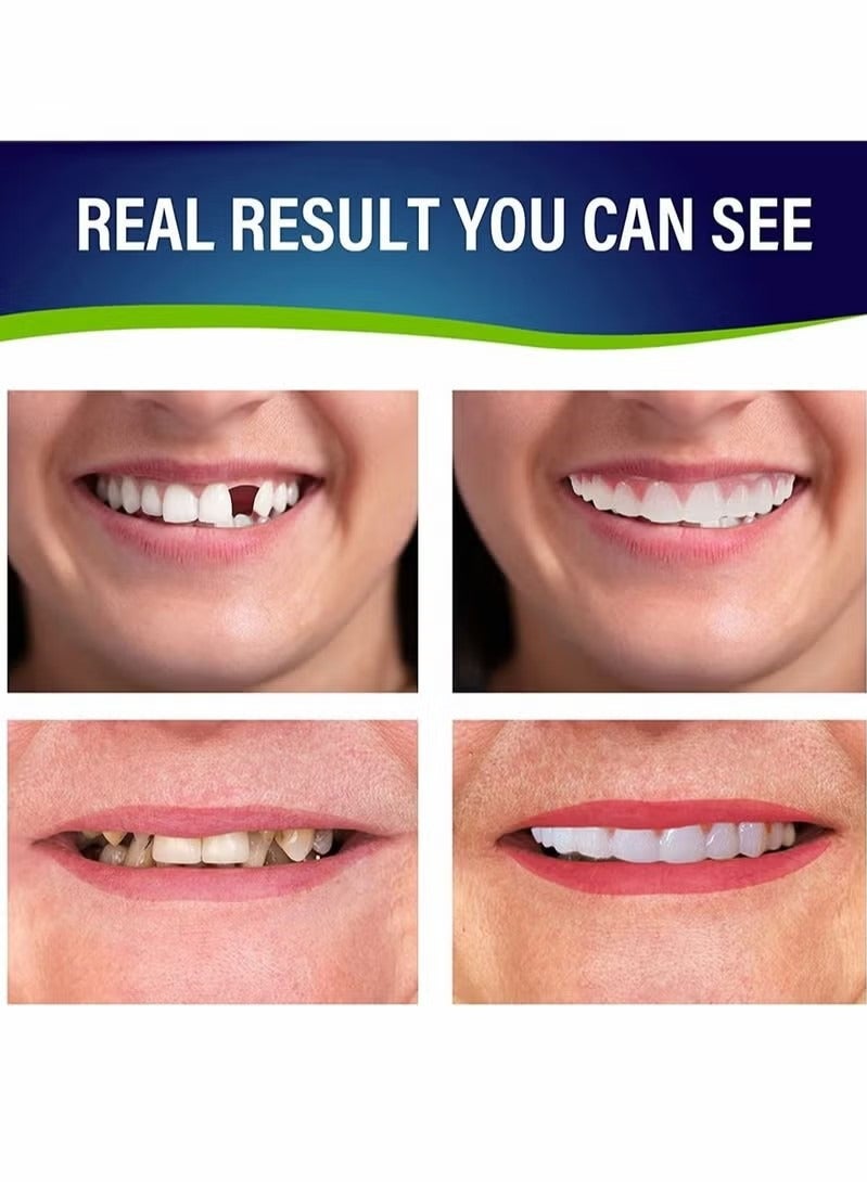 Fake Teeth Dentures Teeth for Women and Men Dental Veneers Temporary Restoration, Nature Comfortable, Protect Your Regain Confident Smile One Size Fits Most (Natural Shade) - Image 2