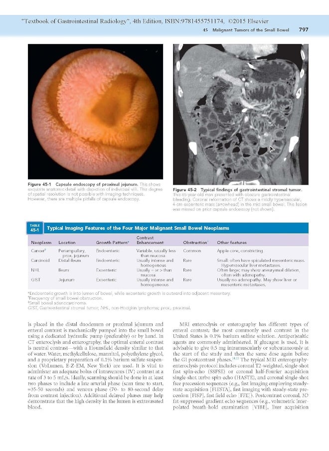 Textbook of Gastrointestinal Radiology, 2-Volume S  - Image 5
