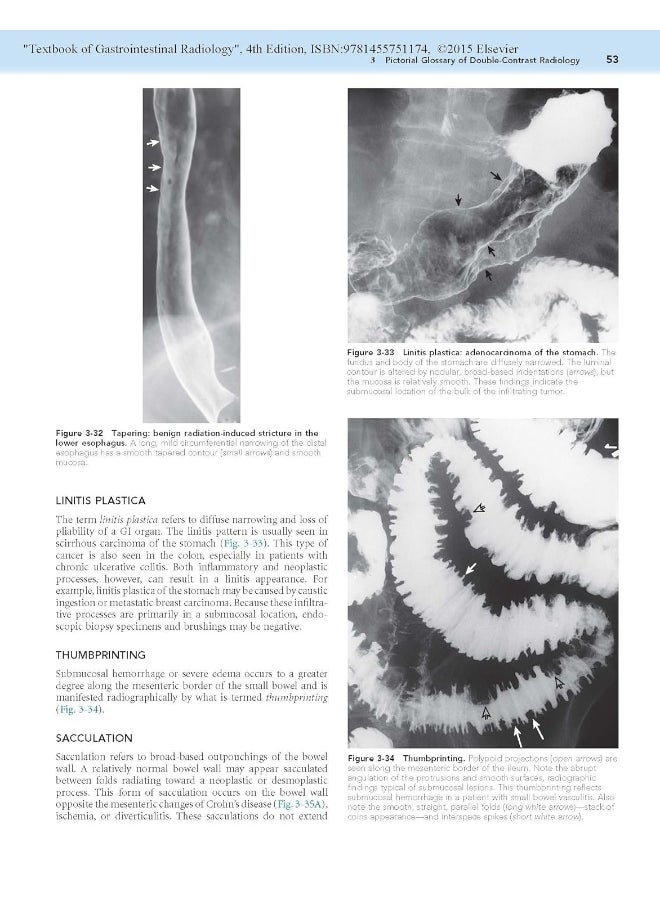 Textbook of Gastrointestinal Radiology, 2-Volume S  - Image 3