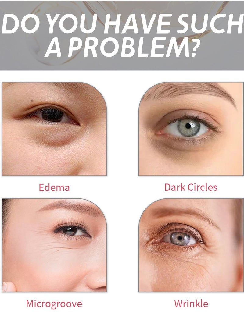 EELHOE - Eye Cream for Dark Circles and Puffiness, Anti Aging Eye Cream with Hyaluronic Acid and Collagen, Under Eye Cream Dark Circles and Puffiness - Image 1