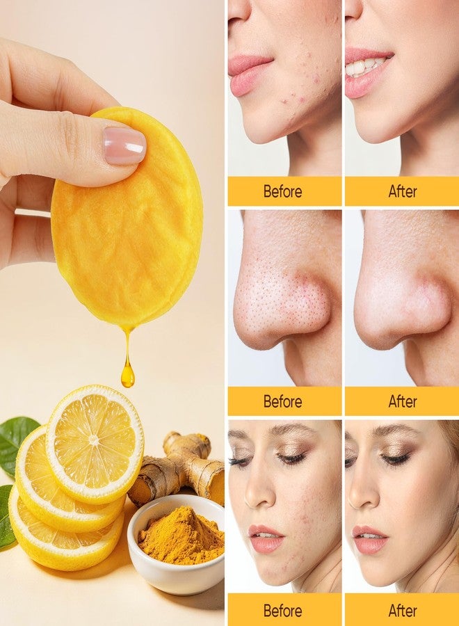 AUSLKA Turmeric Kojic Acid Cleansing Pads, Face Scrub Pads Cleansing Oil Brighten Skin Tone, Turmeric Face Scrub Pads Reduce Pimple and Blackhead - Image 3