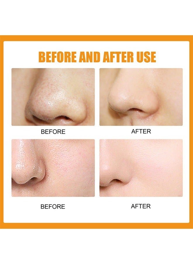 EELHOE "Hydrocolloid Nose Patche, Clean and Shrink Pores, Remove Blackhead and Acne Nose Patch, Remove Blackhead Nose Patch Skin Care Derived Blackhead Acne Nose Patch Tear Nose Mask Gentle Deep Clean 10pcs " - Image 4