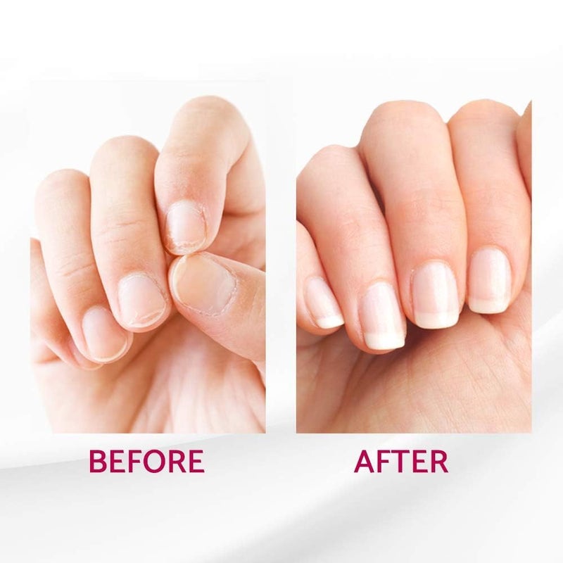 Ibd علاج إصلاح الأظافر IBD Reconstrux – مقوي للأظافر الضعيفة والتالفة، علاج لنمو الأظافر للأظافر المتقشرة والهشة – 0.125 أونصة سائلة، عبوتين - Image 5