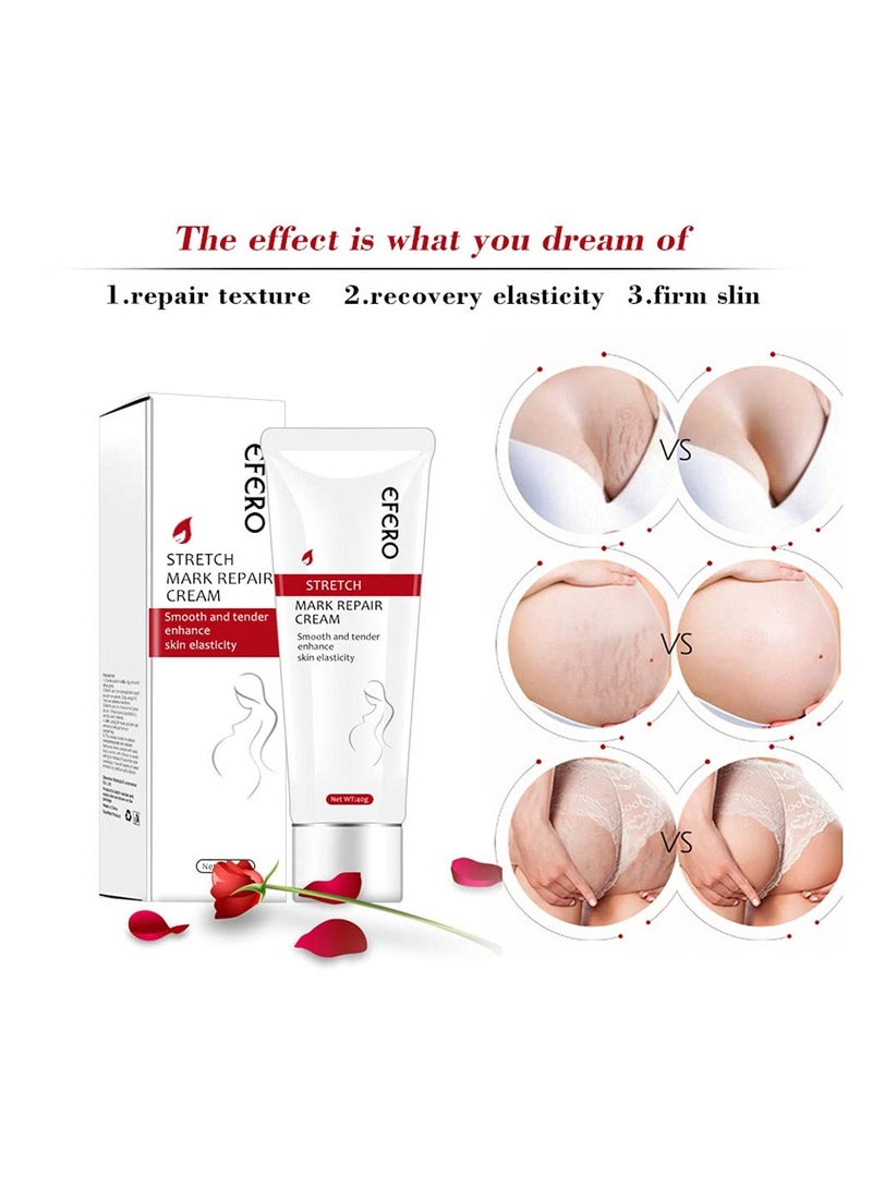 SYOSI 2 قطع كريم إزالة علامات التمدد، علامات الحمل السيئة للنساء وندبات حب الشباب، ترطيب وتثبيت بشرة الجسم، كريم علامات التمدد والندبات، كريم إزالة علامات التمدد والندبات للحمل - Image 5