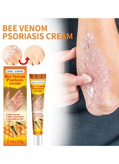 SOL LORA Bee Venom Psoriasis Cream, New Zealand Bee Venom Professional Psoriasis Cream For Itchy Skin Fast Relief Cream For Face And Body, Soothing And Moisturizing Psoriasis Cream 20G  - Image 2