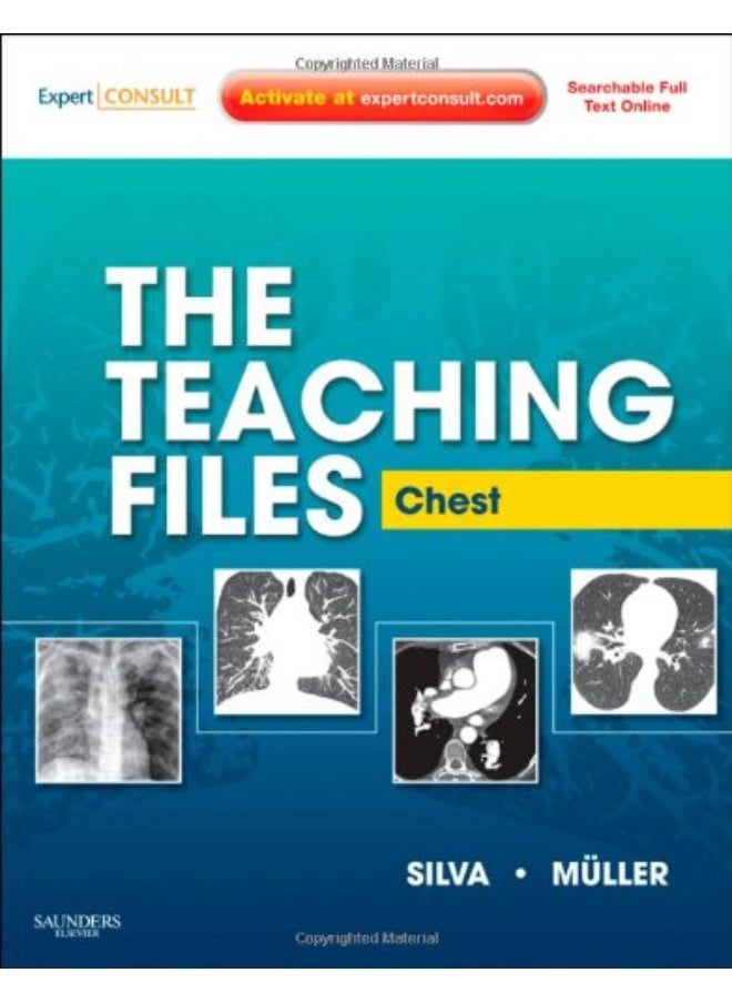 The Teaching Files: Chest: Expert Consult - Online and Print  - Image 1