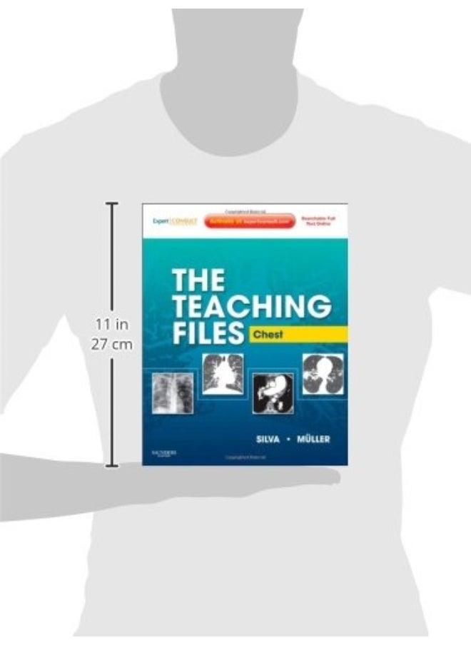 The Teaching Files: Chest: Expert Consult - Online and Print  - Image 2
