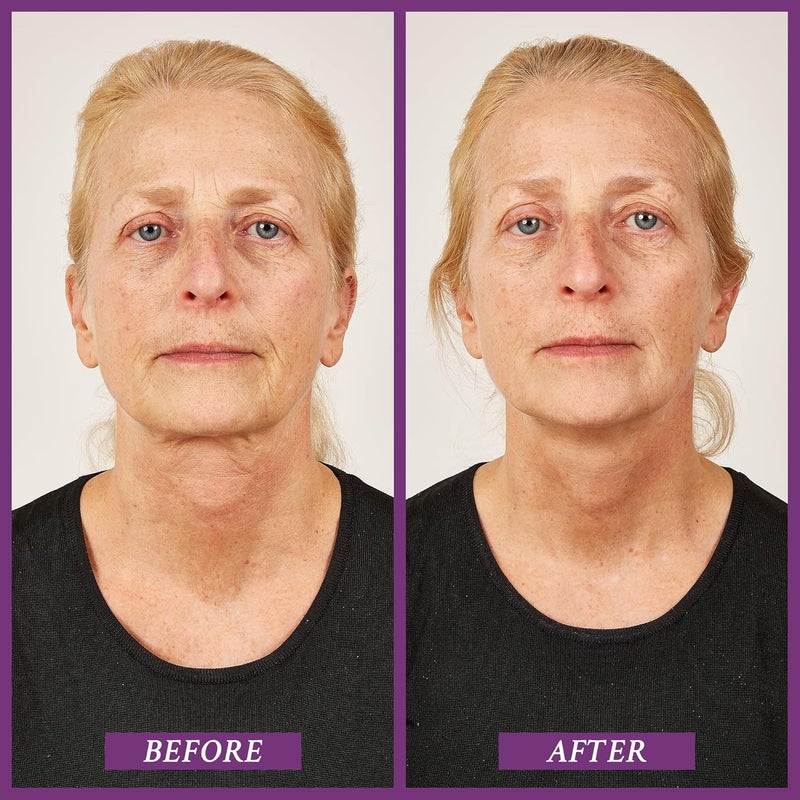 PRAI Beauty Ageless Throat Caviar Overnight Recovery Serum for Instantly Ageless Neck Neck Firming and Tightening Serum 17 Oz - Image 3