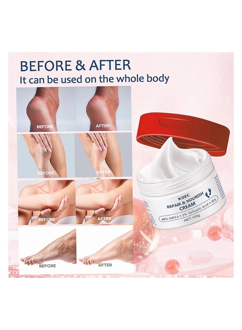 KOEC 40% Urea Cream for Dry Foot, Cracked & Scaly Skin Moisturizing Hand Cream with 2% Salicylic Acid & Hyaluronic Acid, for Callus Treatment on Hands, Heels, Elbows, Nails & Knees - Image 4