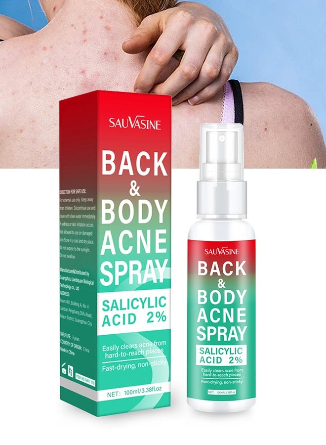 SAUVASINE Back & Body Acne Spray, Gentle Oil Control for Acne, Redness Relief, Smooth Skin, Cleans Pores, Moisturizes, Quick Dry Formula for All Skin Types (100ml) - Image 1