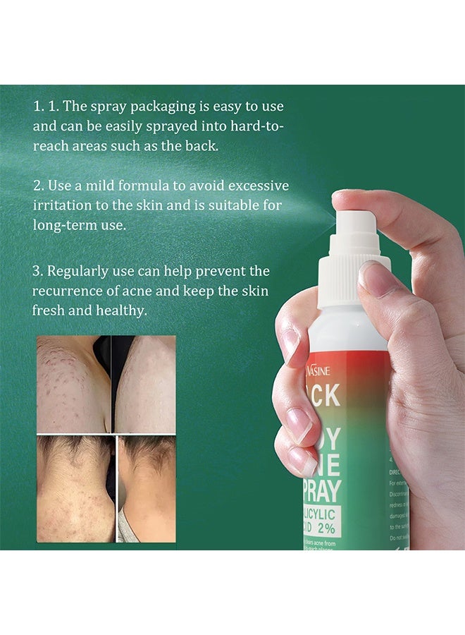 SAUVASINE Back & Body Acne Spray, Gentle Oil Control for Acne, Redness Relief, Smooth Skin, Cleans Pores, Moisturizes, Quick Dry Formula for All Skin Types (100ml) - Image 5