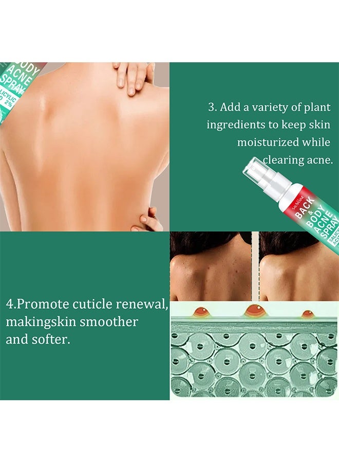 SAUVASINE Back & Body Acne Spray, Gentle Oil Control for Acne, Redness Relief, Smooth Skin, Cleans Pores, Moisturizes, Quick Dry Formula for All Skin Types (100ml) - Image 4