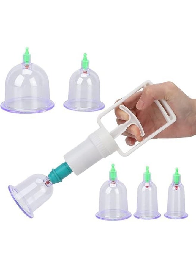 6-Piece Cupping Therapy Set with Hand Pump – Traditional Healing at Home - Image 1