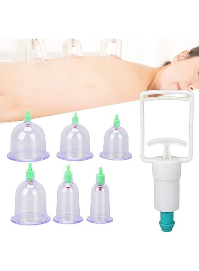 6-Piece Cupping Therapy Set with Hand Pump – Traditional Healing at Home - Image 2