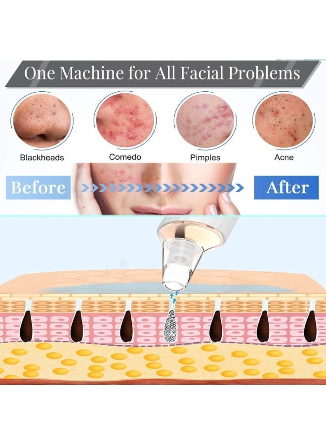 Woofixer Electric Blackhead Remover Vacuum, Pore Cleaner Tool with 4 Suction Heads, Facial Deep Cleaning Device for Nose & T-Zone, USB Rechargeable - Image 5