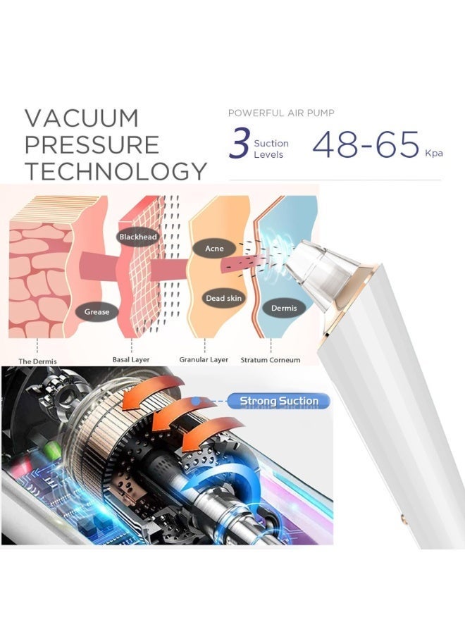 Woofixer Electric Blackhead Remover Vacuum, Pore Cleaner Tool with 4 Suction Heads, Facial Deep Cleaning Device for Nose & T-Zone, USB Rechargeable - Image 2