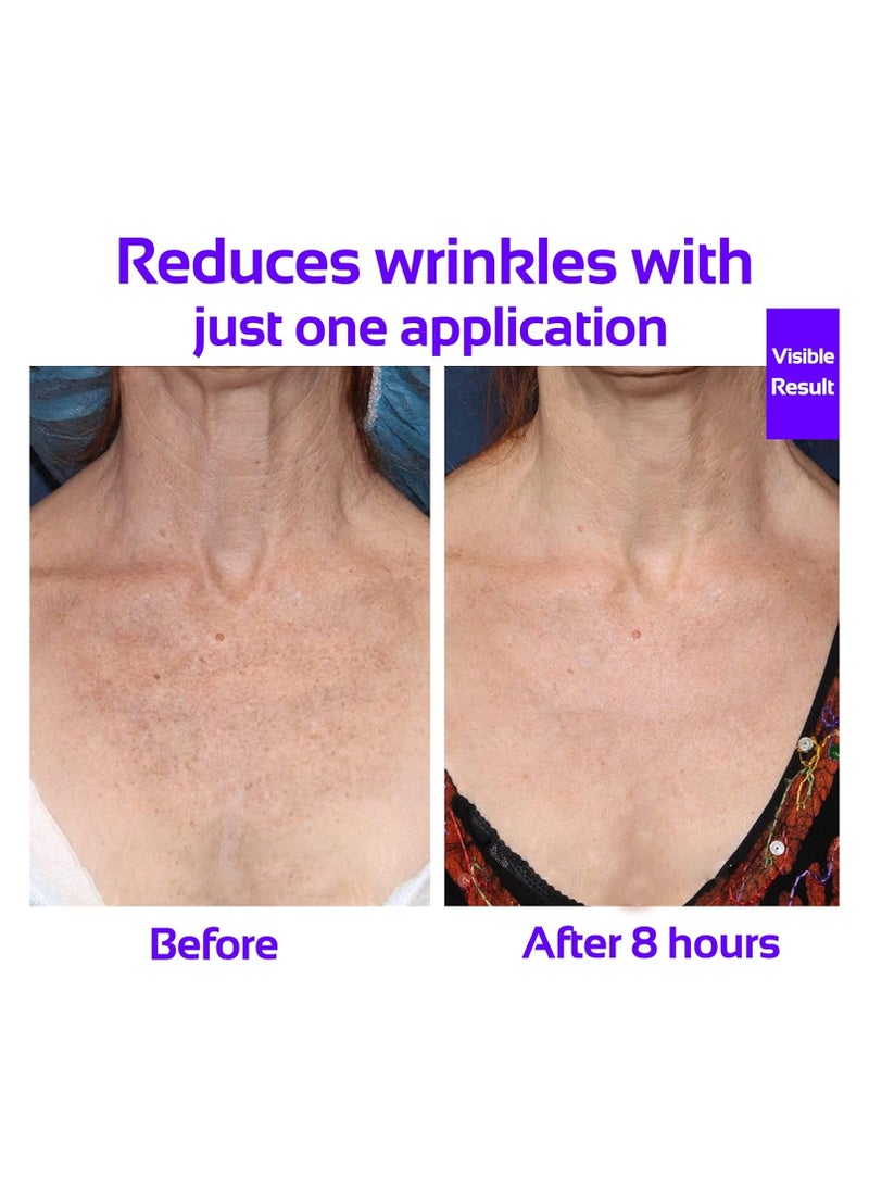 Generic Anti Wrinkle Chest Silicone Pad, Resuable and Anti Wrinkle Patches, Smooth Your Skin Set of 2  - Image 1