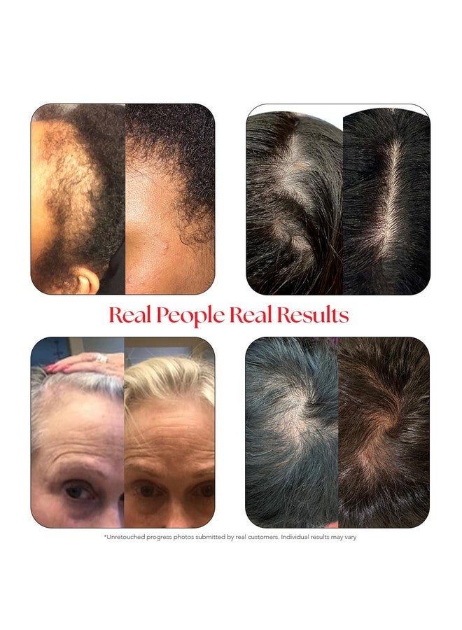 هيرتامين سيروم هيرتامين لفروة الرأس | شعر أكثر كثافةً وتغذيةً وفروة رأس صحية (عبوة من قطعتين) - Image 3