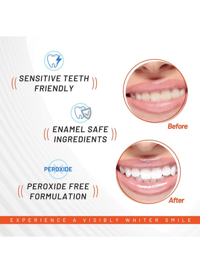 White Glo Charcoal Deep Stain Remover Activated Charcoal Strips, Remove 10 Years of Stains in 7 Days, Long Lasting Results, Comfortable Use with Non-Slip Strips, Perfect for Sensitive Teeth - 7 Uses - Image 5