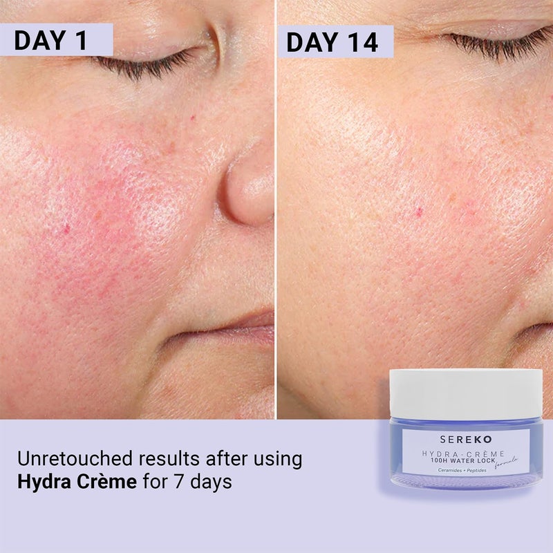 SEREKO Hydra Creme Ceramide Moisturizer Skin Barrier Repair Cream Long Lasting Hydration Up To 100 Hours Locks Moisture With Peptide Lightweight Gel Formula All Skin Types For Men  Women 50ml - Image 5