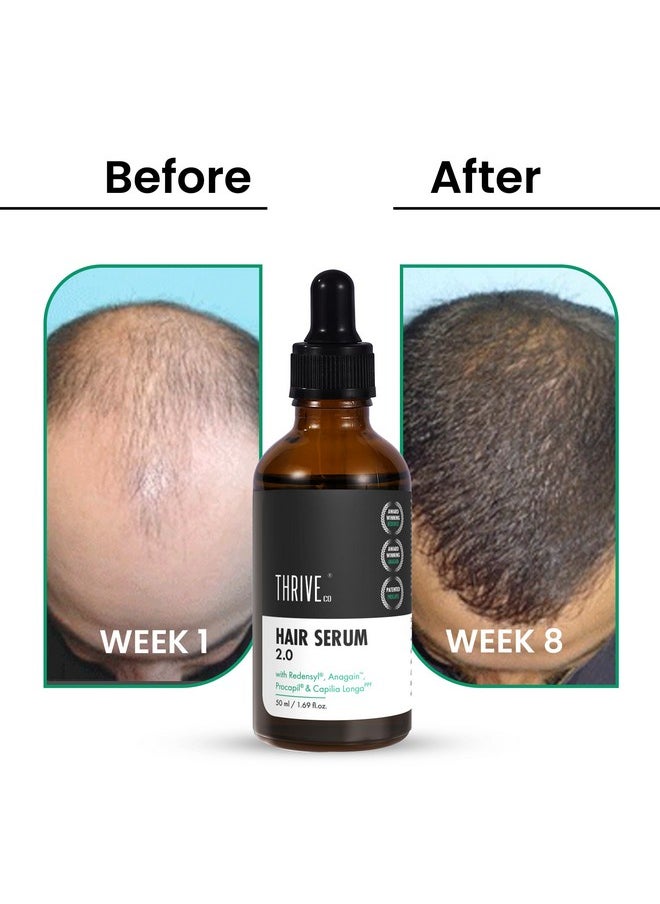 THRIVECO - Hair Growth Serum | With Redensyl Anagain Procapil & Capilia Longa For Hair Fall Control | For Men & Women | 50Ml - Image 1