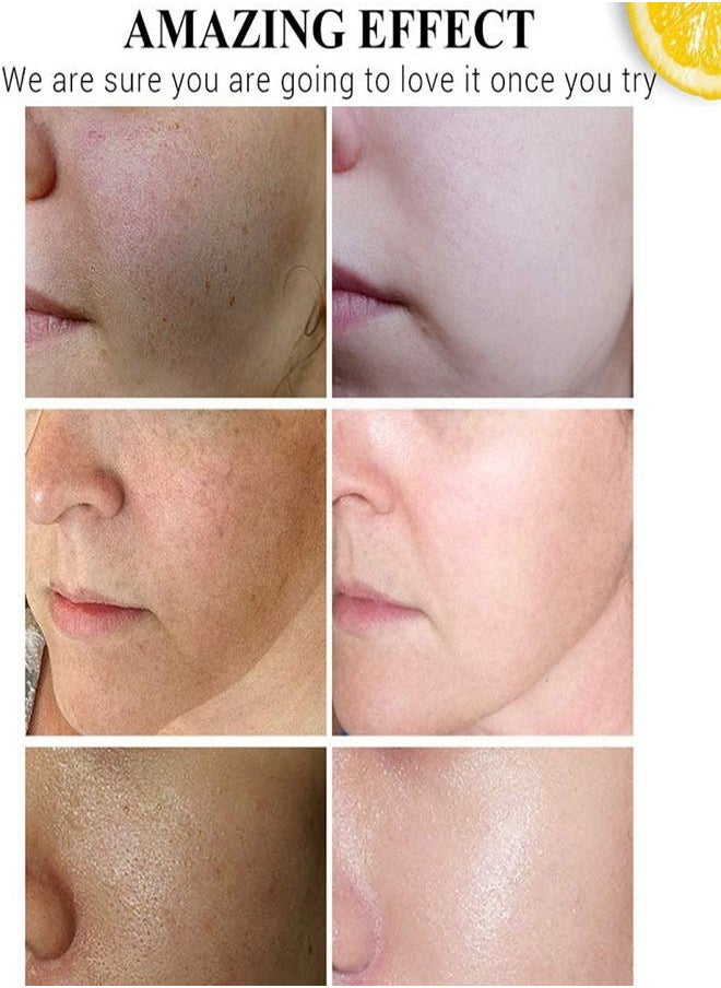 Disaar Vitamin C Hyaluronic Acid Whitening Face Serum 30ml  - Image 5