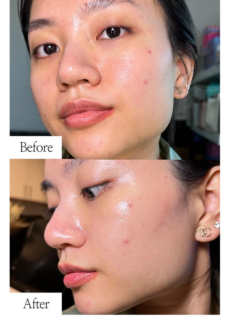 دي آر.ألثيا كريم دكتور ألثيا المرطب والمهدئ 345، 50 مل + كريم ريليف صن: الأرز + البروبيوتيك 50 مل - Image 5