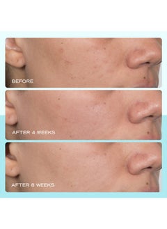 First Aid Beauty First Aid Beauty - Dark Spot Serum with Niacinamide, Helps Reduce Look of Dark Spots, Sun Spots, Hyperpigmentation, Discoloration & Post-acne marks, Non-Comedogenic, Safe for Sensitive Skin, 1 oz  - Image 4