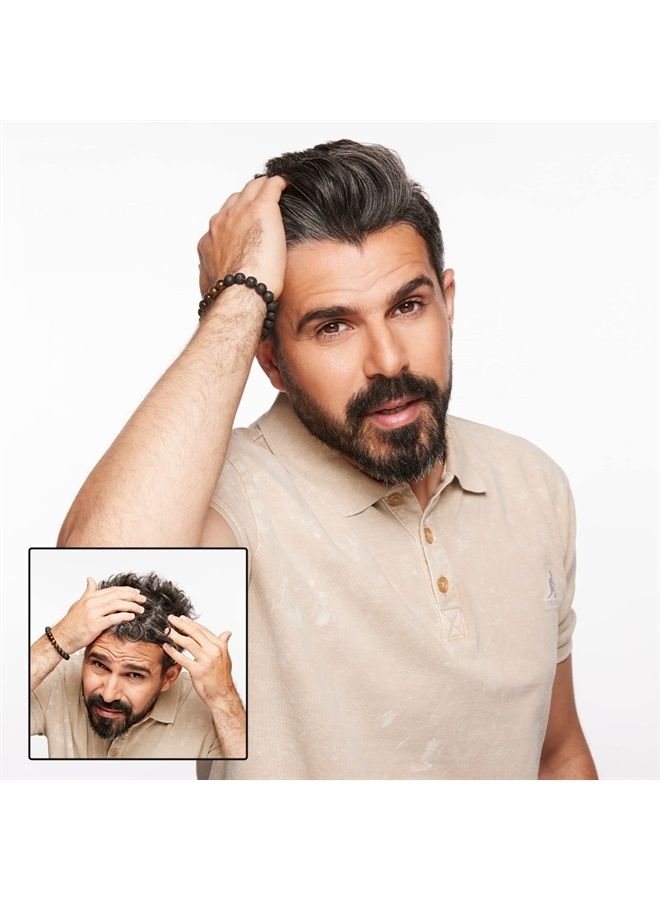 Surface Hair شامبو أويكن العلاجي، 10 أونصة سائلة (عبوة من 1) - Image 2