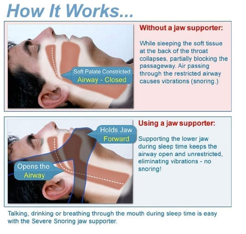 BANCROFT Polycotton Anti Snoring Chin Strap Best Stop | Snoring Device | Adjustable Snore | Reduction Belt Sleep | Aids Chin Strips | New Anti-Snoring Belt | For Men Women Snoring Solution - Image 5