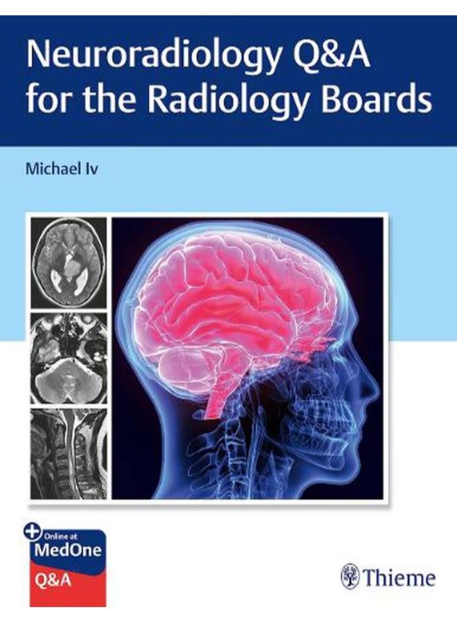 Neuroradiology Q&A for the Radiology Boards  Ed   1