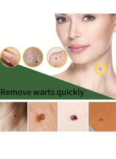 iBealee Skin Tag Remover Pen Fast Skin Tag Removal Effective Safe for Face and Body Tags Mole Wart Skin Tag Remover Serum Painless No Scars Easy Use Wart Remover Liquid  - Image 5