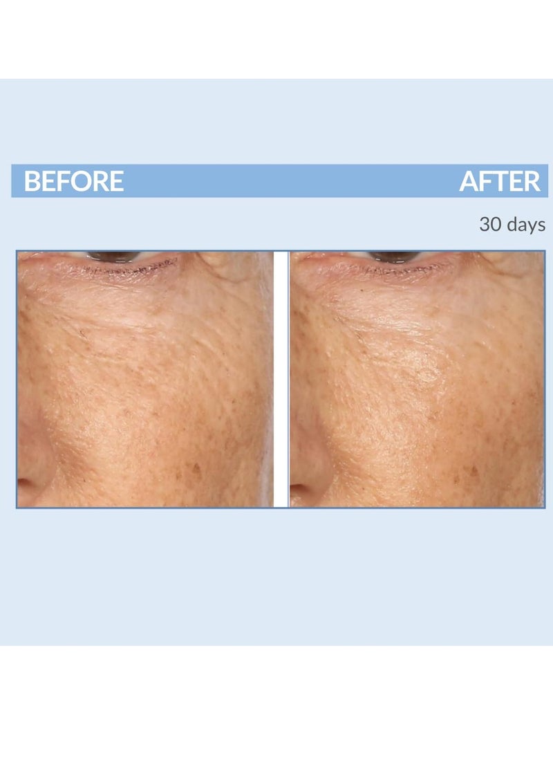 Serious Skincare Serious Skincare Retinol Vitamin A Cream XR Premium Moisture Cream for Face & Neck - Anti-Aging - Day & Night - Reduce Fine Lines & Wrinkles - For Radiant Skin Age Defiance - 2 Fl. Oz.  - Image 3