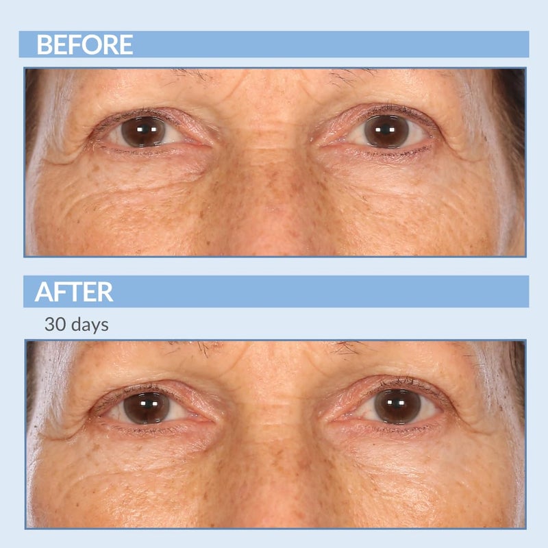 Serious Skincare Retinol Cream For Face - Vitamin A Cream XR Premium Moisturizer - Anti-Aging - Day & Night - Reduce Fine Lines & Wrinkles - For Radiant Skin 2 Fl. Oz. - Image 5