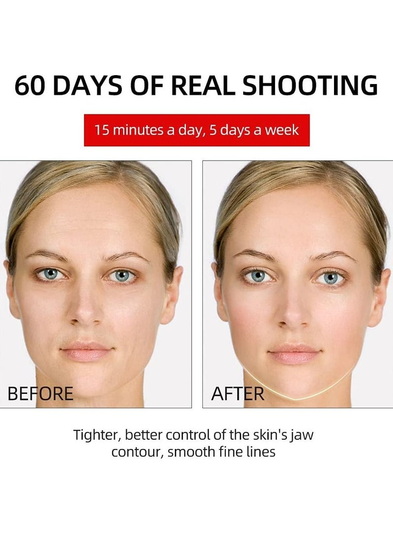 Face Slimming Massager With Skin Rejuvenation V Face Shaping Massager  Face Slimming Vibration Device Chin (White) - Image 2