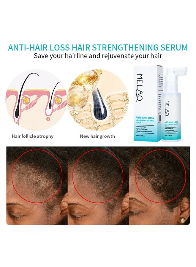 MELAO Anti-Hair Losshair Strengthening Serum，Stable Hair RootImprove Hair LossMoisturizes Hair Follicles，Minoxidil Anti-Hair Loss Topical Hair spray 60ml - Image 3