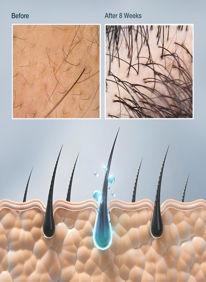 SiyaAyurveda Hair Growth Serum with 2% Redensyl & Javakusum Extract for Scalp - Image 5