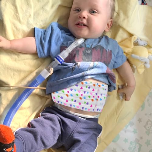 rainbowstar Adjustable G Tube Protective Belt for Babies Feeding Tube Belt G Tube Tummy Time Pillow Belly Band for G Tube or GJ Tube Babies Toddlers - Image 5
