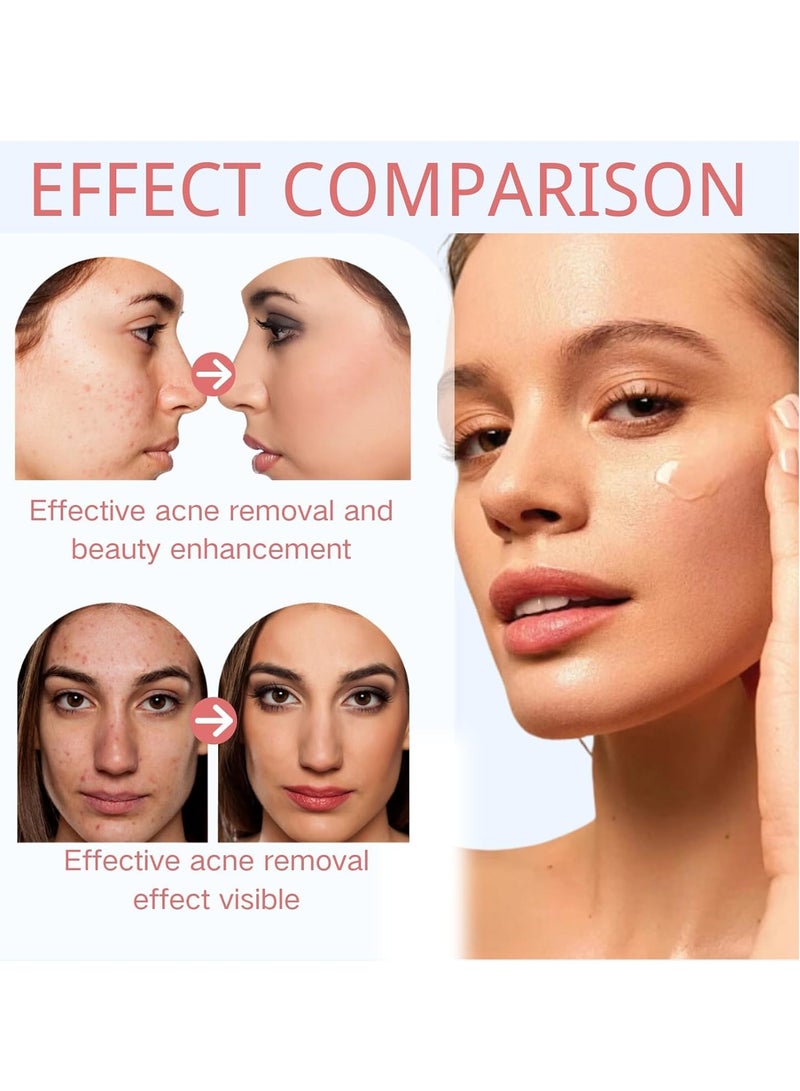 FUSHITING Azelaic Acid 15% Acne Tratment Cream, Acne Cream for Face, Spot Treatment, Anti Acne Gel For Spot Prone Skin, Rosacea Reducing Relief Pimple Breakouts Blackhead Pigmentation and Redness,Hydrate 15g - Image 4