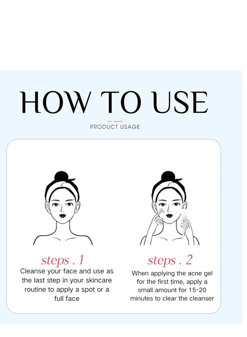 FUSHITING Azelaic Acid 15% Acne Tratment Cream, Acne Cream for Face, Spot Treatment, Anti Acne Gel For Spot Prone Skin, Rosacea Reducing Relief Pimple Breakouts Blackhead Pigmentation and Redness,Hydrate 15g - Image 5