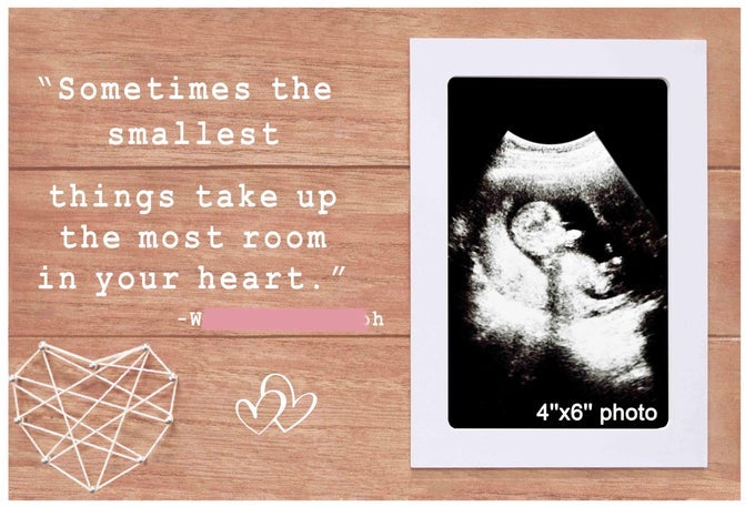 PREGNANCY ANNOUNCEMENT GIFTSBABY SONOGRAM GIFTBABYS 1ST PICTURESOMETIMES THE SMALLEST THINGS TAKE UP THE MOST ROOM IN YOUR HEARTWOODEN PICTURE FRAME PHOTO FRAME