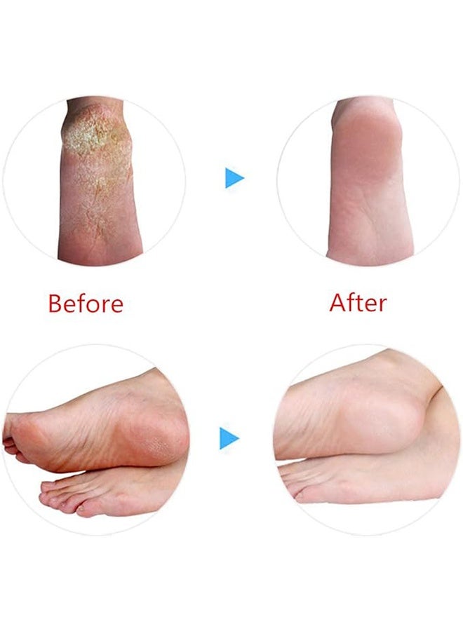 2 Pairs Silicone Moisturizing Socks Softening Dry Feet, Rough Skins & Anti Slip Aloe Socks for Dry Feet Women, Calluses, Spa Gel Socks Foot Care After Pedicure - Image 3